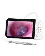 Telstar MS500 5" HD Large Screen Illuminated Ear Spoon 3.9mm Diameter Visual Ear Collection Tool // Telstar MS450 4.5" HD Smart Screen Otoscope with 32GB Memory Card